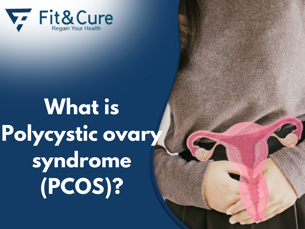 What is Polycystic ovary syndrome (PCOS)?
